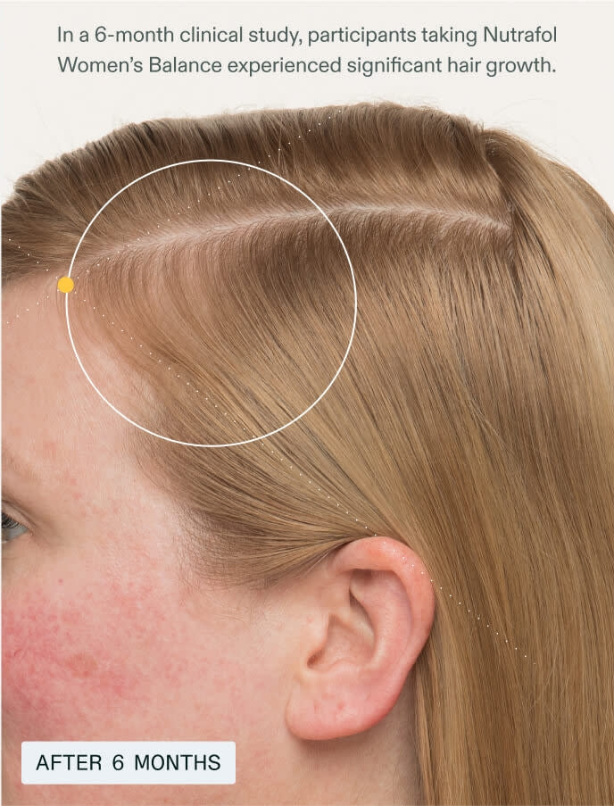 Nutrafol Women's Balance Hair Growth Supplements