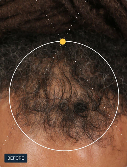 Supplements Nutrafol Men Hair Growth
