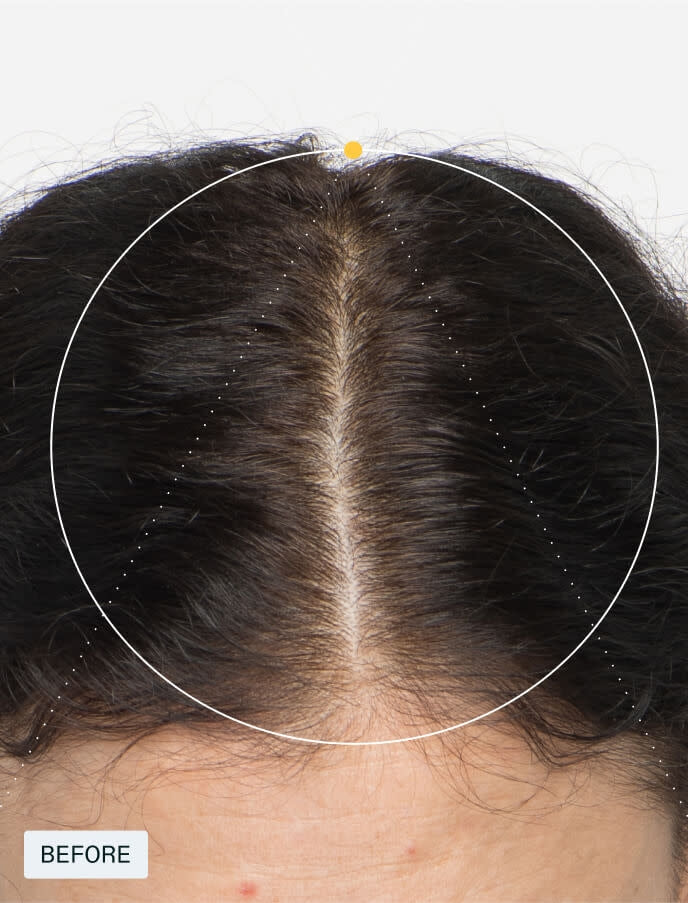 Nutrafol Women HairGrowth Supplements, Ages18-44,1-Month Bottle