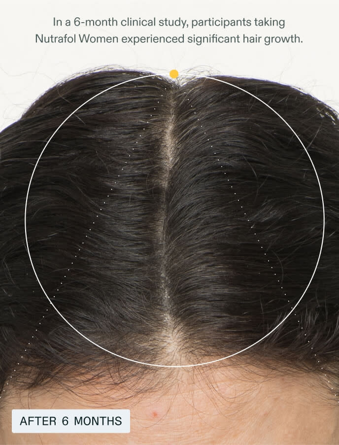 Nutrafol Women HairGrowth Supplements, Ages18-44,1-Month Bottle